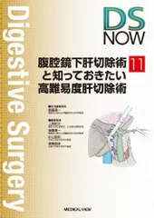 腹腔鏡下肝切除術と知っておきたい高難易度肝切除術 (DS NOW 11)