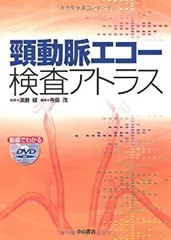 臨床のための頸動脈エコー測定法 第2版 | 山崎 義光 |本 | 通販