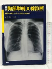 【初版】 胸部X線診断クイズ 櫛橋民夫