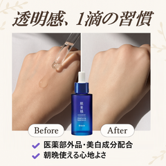 肌美精 薬用美白美容液 30mL 【医薬部外品】 高純度ビタミンC トラネキサム酸 W有効成分配合 シミ そばかす 透明感 毛穴 乾燥くすみ 対策 美白ケア 美容液 肌荒れ 毛穴 ニキビ 敏感肌 低刺激 トラブル肌 ニキビ跡