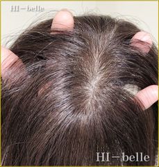 自毛引出しウィッグ・ヘアピース【通販限定】【新品】【ノーカット】【男女使用可】/　青山ハイベル通販サイトにて売り切れが多い人気のヘアウィッグ