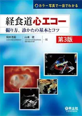 2025年最新】経食道心エコーの人気アイテム - メルカリ