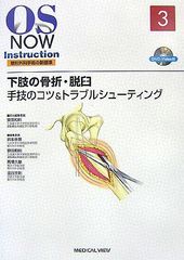 上肢の骨折・脱臼 : 手技のコツ&トラブルシューティング　DVD付き OS NOW Instruction No.3 下肢の骨折・脱臼 - メルカリ