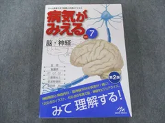 2024年最新】病気がみえる 脳 第2版の人気アイテム - メルカリ