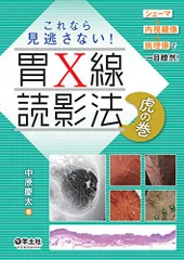 2024年最新】胃x線読影の人気アイテム - メルカリ