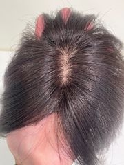 【メルカリ限定】【一点のみ】つむじ用ヘアピース