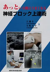 2025年最新】あっという間にうまくなる神経ブロック上達術の人気