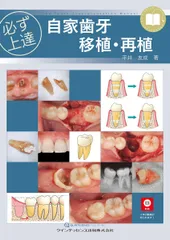 必ず上達 自家歯牙移植・再植 (必ず上達シリーズ)