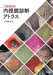 2025年最新】下部消化管内視鏡診断アトラスの人気アイテム