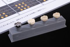 大臼歯クラウン４種見本と比較表セット