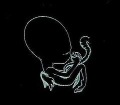 アゲイティス・ビリュン 【CD、音楽 中古 CD】レンタル落ち