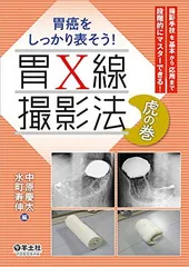 2025年最新】X線撮影法の人気アイテム - メルカリ