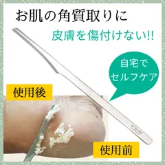 角質取り タコ 魚の目 フットケア 角質ケア かかと スキンケア 美容 角質削り 角質除去 肌 乾燥 カサカサ ツルツル お風呂 お手入れ 水洗い ステンレス コンパクト 持ち運び 家 旅行先 自分磨き 靴下 ひっかかるのサムネイル