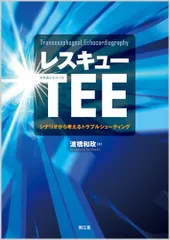 2025年最新】経食道心エコーの人気アイテム - メルカリ