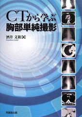 胸部CTの立体解剖 第二版: 特典:Webで連続スライスが見られる 第2版