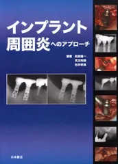 2025年最新】インプラント周囲のの人気アイテム - メルカリ
