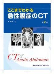 2023年最新】急性腹症のctの人気アイテム - メルカリ