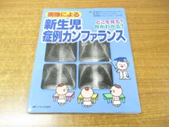 画像による新生児症例カンファランス どこを見る? 何がわかる? - メルカリ