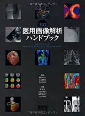 2025年最新】実践 医用画像解析ハンドブックの人気アイテム