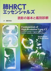 裁断済み】肺HRCT 原書5版 Webb他 - メルカリ
