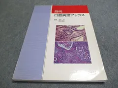 口腔病理アトラス　病理学　教科書 口腔病理アトラス | 高木 實, 高田 隆, 豊澤 悟 |本 | 通販 | Amazon