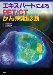 エキスパ-トによるPET/CTがん病期診断