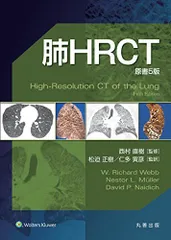 肺HRCT 原書5版 Amazon.co.jp: 肺HRCT 原書5版 : 西村 直樹, 松迫 正樹, 仁多