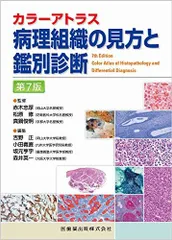 未使用「眼病理アトラス」 眼疾患アトラスシリーズ 第4巻 眼病理アトラス｜株式会社総合医学社