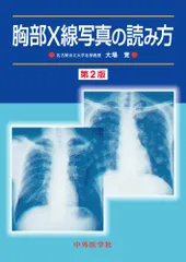 胸部X線・胸部レントゲン・胸部エコー 医学書３冊セット 胸部X線写真のABC (日本医師会生涯教育シリーズ 22) | 片山 仁